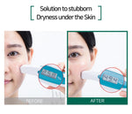 SOME BY MI AHA BHA PHA 30 Days Miracle Toner | Korean Skincare Canada