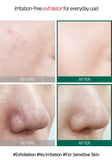 SOME BY MI AHA BHA PHA 30 Days Miracle Toner | Korean Skincare Canada