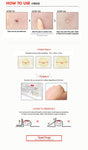 COSRX Acne Pimple Master Patch |  Canada & USA | Korean Skincare 